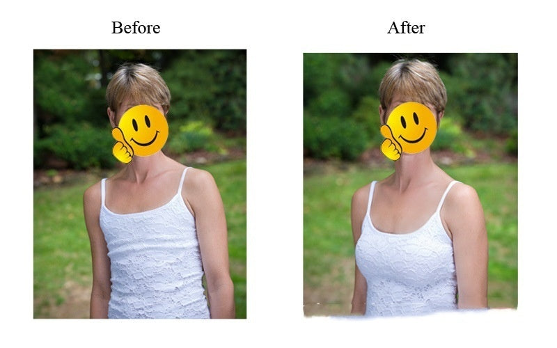 Strapped & Strapless Silicone Breast Collection